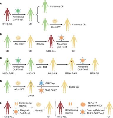 How to Combine the Two Landmark Treatment Methods—Allogeneic Hematopoietic Stem Cell Transplantation and Chimeric Antigen Receptor T Cell Therapy Together to Cure High-Risk B Cell Acute Lymphoblastic Leukemia?